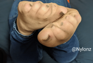 Nude pantyhose feet with black toe nail polish with jeans on the bed